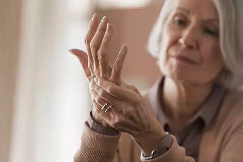 Ältere Dame hat Arthritis in den Händen